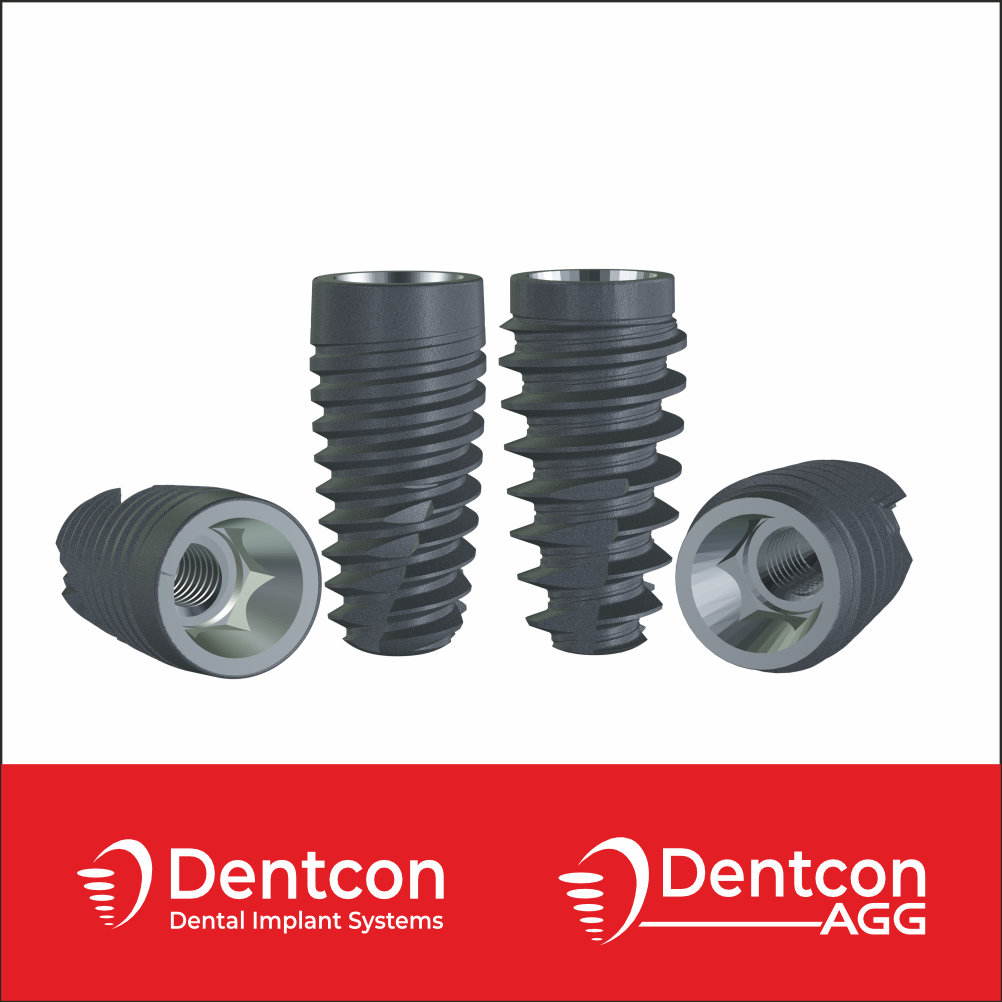 Dentcon
